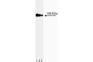Western blot analysis of DNA Topoisomerase I. (Topoisomerase I Antikörper)