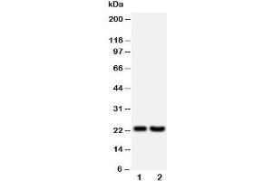 Western blot testing of FGF9 antibody and Lane 1:  rat brain;  2: HeLa;  Predicted size: 23KD;  Observed size: 23KD