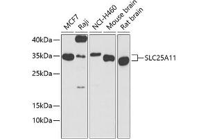 Western blot analysis of extracts of various cell lines, using SLC25 antibody (ABIN6132660, ABIN6147903, ABIN6147904 and ABIN6224187) at 1:1000 dilution. (SLC25A11 Antikörper  (AA 1-314))