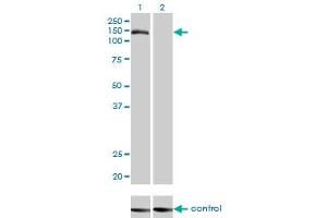 Western blot analysis of TMEM1 over-expressed 293 cell line, cotransfected with TMEM1 Validated Chimera RNAi (Lane 2) or non-transfected control (Lane 1).