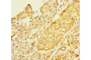Immunohistochemistry of paraffin-embedded human pancreatic tissue using ABIN7176608 at dilution of 1:100 (ZKSCAN2 Antikörper  (AA 1-300))