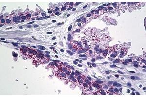 Human Prostate: Formalin-Fixed, Paraffin-Embedded (FFPE) (MMP23B Antikörper  (C-Term))