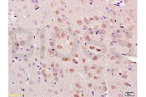 Formalin-fixed and paraffin embedded rat brain tissue labeled with Anti-LLGL1/2 Polyclonal Antibody, Unconjugated (ABIN761966) at 1:200 followed by conjugation to the secondary antibody and DAB staining (LLGL1 Antikörper  (AA 801-900))