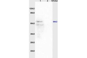 Lane 1: mouse brain lysates Lane 2: mouse heart lysates probed with Anti Iroquois homeobox protein 3 Polyclonal Antibody, Unconjugated (ABIN872921) at 1:200 in 4 °C. (IRX3 Antikörper  (AA 401-501))