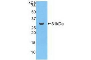 Detection of Recombinant FCN3, Human using Polyclonal Antibody to Ficolin 3 (FCN3)