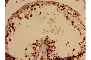 Immunohistochemistry analysis of human testis tissue using ABIN7171638 at dilution of 1:100 (TBC1D31 Antikörper  (AA 662-1001))