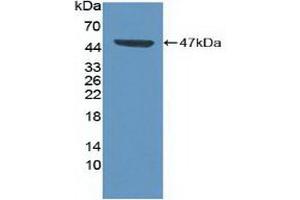 Detection of Recombinant CDK8, Human using Polyclonal Antibody to Cyclin Dependent Kinase 8 (CDK8) (CDK8 Antikörper  (AA 21-392))
