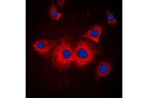 Immunofluorescent analysis of SLK staining in MCF7 cells. (SLK Antikörper  (C-Term))