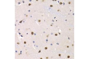 Immunohistochemistry (IHC) image for anti-Interferon Regulatory Factor 2 (IRF2) (AA 120-349) antibody (ABIN3023367)
