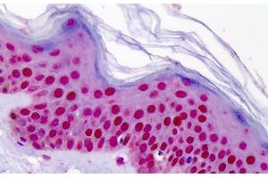 Human Skin: Formalin-Fixed, Paraffin-Embedded (FFPE) (Aryl Hydrocarbon Receptor Antikörper  (AA 2-51))