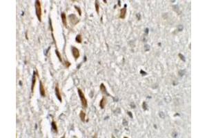 Immunohistochemistry (IHC) image for anti-Teashirt Zinc Finger Homeobox 3 (TSHZ3) (N-Term) antibody (ABIN1031649) (TSHZ3 Antikörper  (N-Term))