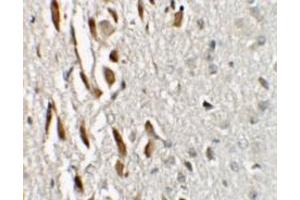 Immunohistochemistry (IHC) image for anti-Zinc Finger Protein 537 (ZNF537) (N-Term) antibody (ABIN1031649) (TSHZ3 Antikörper  (N-Term))