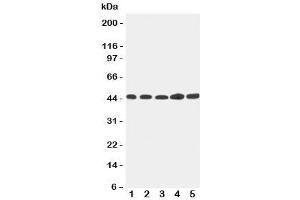 Western blot testing of Hepsin antibody and Lane 1:  293T;  2: NRK;  3: HeLa;  4: PANC;  5: MFC-7 cell lysate. (Hepsin Antikörper  (C-Term))