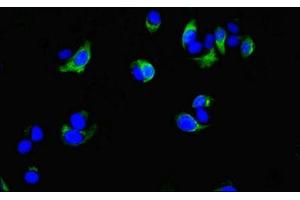 Immunofluorescent analysis of MCF-7 cells using ABIN7148457 at dilution of 1:100 and Alexa Fluor 488-congugated AffiniPure Goat Anti-Rabbit IgG(H+L) (COG4 Antikörper  (AA 506-785))