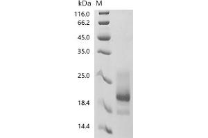 (Tris-Glycine gel) Discontinuous SDS-PAGE (reduced) with 5 % enrichment gel and 15 % separation gel.
