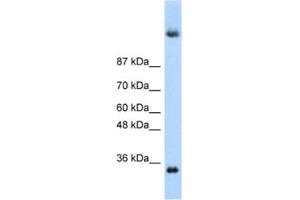 Western Blotting (WB) image for anti-Deleted In Azoospermia 4 (DAZ4) antibody (ABIN2462067)