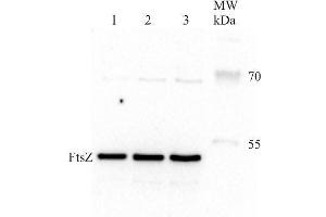 Western Blotting (WB) image for anti-Procaryotic Cell Division Gtpase (Ftsz) antibody (ABIN2749235) (Ftsz Antikörper)