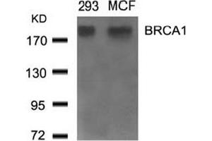 Image no. 2 for anti-Breast Cancer 1 (BRCA1) (Ser1524) antibody (ABIN401620) (BRCA1 Antikörper  (Ser1524))