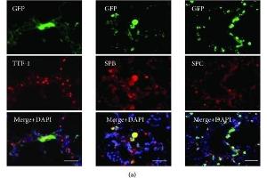 Differentiation of engrafted GFP-labeled ADSCs in the lung of the emphysematous mouse model.