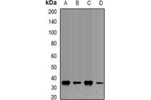 Western blot analysis of Fibrillarin expression in Hela (A), U20S (B), COS7 (C), PC12 (D) whole cell lysates. (Fibrillarin Antikörper)