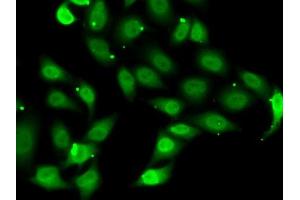 Immunofluorescence analysis of MCF7 cells using TE antibody (ABIN6129489, ABIN6148983, ABIN6148985 and ABIN6222505). (TEAD1 Antikörper  (AA 135-215))