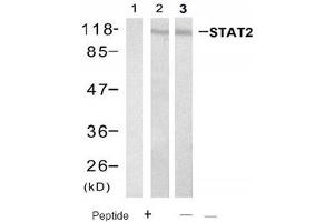 Image no. 1 for anti-Signal Transducer and Activator of Transcription 2, 113kDa (STAT2) (Tyr690) antibody (ABIN319409) (STAT2 Antikörper  (Tyr690))