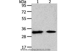 Western blot analysis of Mouse heart and muscle tissue, using SLC25A4 Polyclonal Antibody at dilution of 1:400 (SLC25A4 Antikörper)