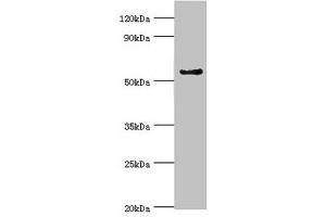 Western blot All lanes: Cytochrome P450 3A5 antibody at 9 μg/mL + Mouse liver tissue Secondary Goat polyclonal to rabbit IgG at 1/10000 dilution Predicted band size: 58, 16 kDa Observed band size: 58 kDa (CYP3A5 Antikörper  (AA 233-502))