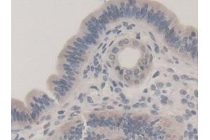 Detection of TUBb1 in Mouse Uterus Tissue using Polyclonal Antibody to Tubulin Beta 1 (TUBb1) (TUBB1 Antikörper  (AA 182-437))