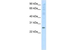 Western Blotting (WB) image for anti-Synaptosomal-Associated Protein, 25kDa (SNAP25) antibody (ABIN2463769) (SNAP25 Antikörper)