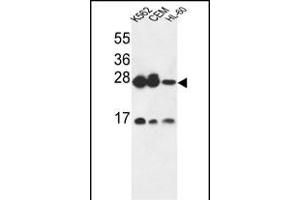 ANP32A Antibody (C-term) (ABIN6243481 and ABIN6579058) western blot analysis in K562,CEM,HL-60 cell line lysates (35 μg/lane). (PHAP1 Antikörper  (C-Term))