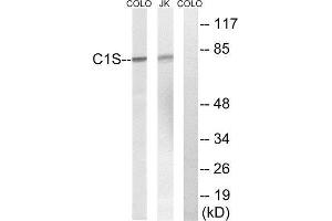 Western Blotting (WB) image for anti-Complement Component 1, S Subcomponent (C1S) (C-Term) antibody (ABIN5977551) (C1S Antikörper  (C-Term))