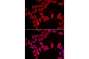 Immunofluorescence (IF) image for anti-Solute Carrier Family 35 (UDP-Galactose Transporter), Member A2 (SLC35A2) (AA 1-242) antibody (ABIN6147991)