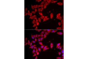 Immunofluorescence analysis of HeLa cells using SLC35 antibody (ABIN6133144, ABIN6147991, ABIN6147992 and ABIN6223068). (SLC35A2 Antikörper  (AA 1-242))