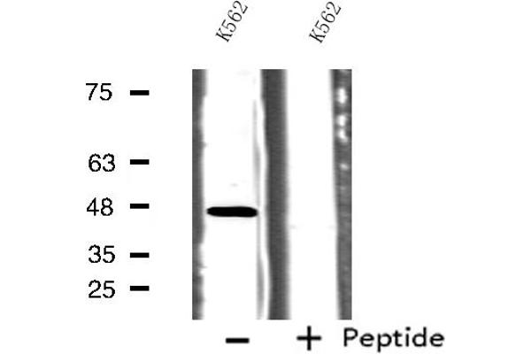 5HT1B Receptor Antikörper  (Internal Region)