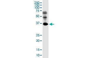EMB monoclonal antibody (M05), clone 3F12.
