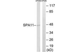 Western blot analysis of extracts from HT-29 cells, using SERPINA11 Antibody. (SERPINA11 Antikörper  (AA 191-240))