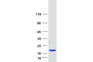 Western Blotting (WB) image for Ionized Calcium-binding Adapter Molecule 1 (IBA1) (Transcript Variant 1) protein (Myc-DYKDDDDK Tag) (ABIN2714479)