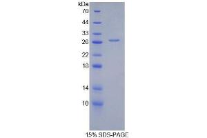 SDS-PAGE (SDS) image for Alanine Aminotransferase (ALT) (AA 255-492) protein (His tag) (ABIN1877166) (ALT Protein (AA 255-492) (His tag))