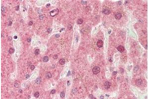 Human, Liver: Formalin-Fixed Paraffin-Embedded (FFPE) (CYP3A4 Antikörper  (AA 398-447))