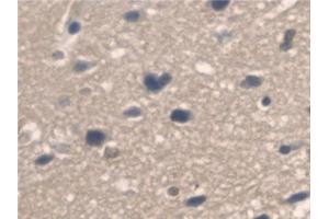 Detection of PNPO in Mouse Cerebrum Tissue using Polyclonal Antibody to Pyridoxamine-5'-Phosphate Oxidase (PNPO) (PNPO Antikörper  (AA 1-261))
