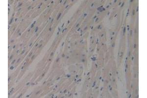 IHC-P analysis of Mouse Heart Tissue, with DAB staining. (MUC1 Antikörper  (AA 474-630))