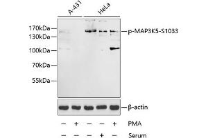 Western blot analysis of extracts of A-431 and HeLa cells, using Phospho-MK5-S1033 antibody (ABIN3019484, ABIN3019485, ABIN3019486 and ABIN6225423) at 1:1000 dilution. (ASK1 Antikörper  (pSer1033))