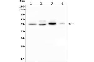Western blot analysis of CD1D using anti-CD1D antibody (ABIN7600538).