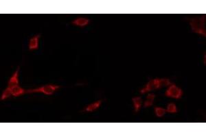 ABIN6272249 staining Hela by IF/ICC. (ARRDC1 Antikörper  (C-Term))