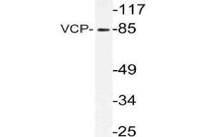 Western blot (WB) analysis of VCP antibody in extracts from 3T3 cells. (VCP Antikörper)