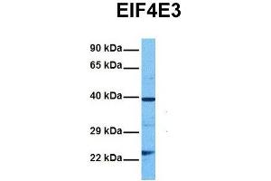 Host:  Rabbit  Target Name:  EIF4E3  Sample Tissue:  Human DLD1  Antibody Dilution:  1.