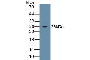 Detection of Recombinant PDGFB, Porcine using Polyclonal Antibody to Platelet Derived Growth Factor Subunit B (PDGFB) (PDGFB Antikörper  (AA 84-199))