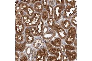 Immunohistochemical staining of human kidney with TRMT61B polyclonal antibody  shows strong cytoplasmic positivity in tubular cells. (TRMT61B Antikörper)