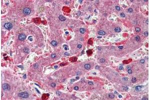 Human Liver: Formalin-Fixed, Paraffin-Embedded (FFPE) (CBS Antikörper  (AA 1-101))